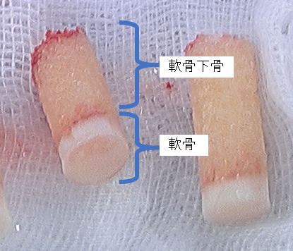 図2 自身の身体から採取した移植前の骨軟骨柱