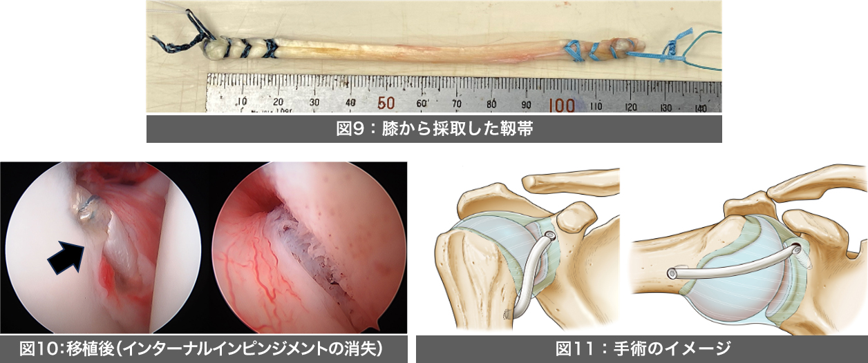 投球動作を伴うスポーツ選手